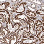 Merck Anti-CHRM2 antibody produced in rabbit