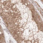 Merck Anti-MICAL2 antibody produced in rabbit