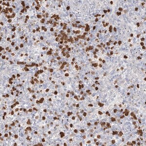 Merck Anti-ZNF227 antibody produced in rabbit