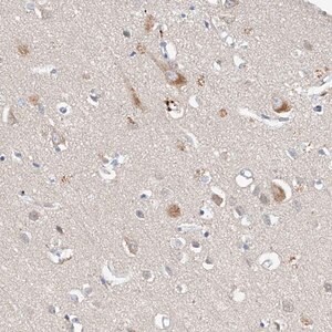 Merck Anti-CARMIL3 antibody produced in rabbit