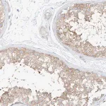 Merck Anti-PPP6R2 antibody produced in rabbit