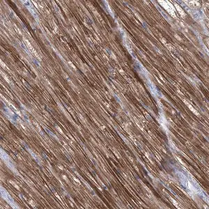 Merck Anti-SBK2 antibody produced in rabbit