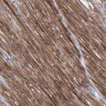 Merck Anti-SBK2 antibody produced in rabbit