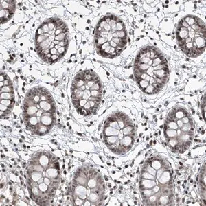 Merck Anti-IRF2 antibody produced in rabbit