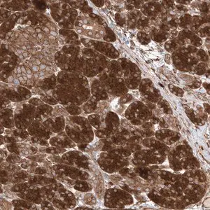 Merck Anti-YKT6 antibody produced in rabbit