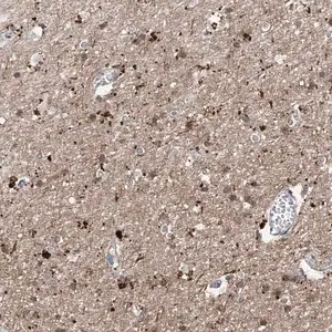 Merck Anti-ANGEL2 antibody produced in rabbit