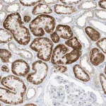 Merck Anti-OGT antibody produced in rabbit