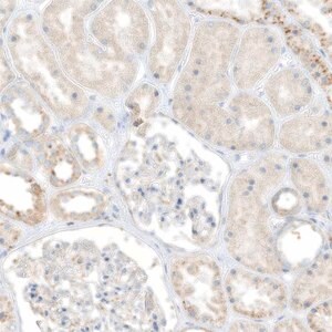Merck Anti-TAL2 antibody produced in rabbit