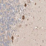 Merck Anti-MOSPD1 antibody produced in rabbit