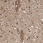 Merck Anti-TAGAP antibody produced in rabbit