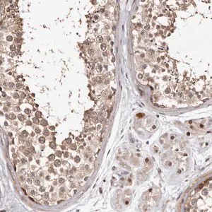 Merck Anti-PHF20L1 antibody produced in rabbit