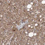 Merck Anti-TNKS antibody produced in rabbit