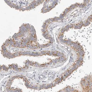 Merck Anti-ELP3 antibody produced in rabbit