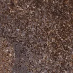 Merck Anti-PRKCH antibody produced in rabbit