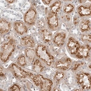 Merck Anti-SUGCT antibody produced in rabbit