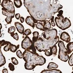 Merck Anti-TCHH antibody produced in rabbit
