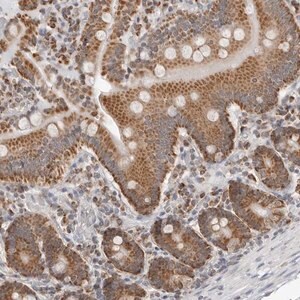 Merck Anti-PLD5 antibody produced in rabbit