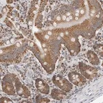 Merck Anti-PLD5 antibody produced in rabbit