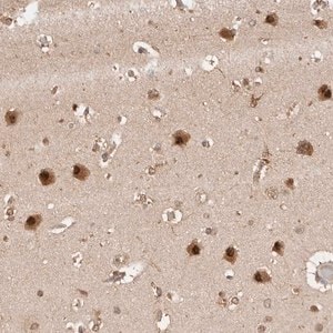 Merck Anti-PSMA5 antibody produced in rabbit