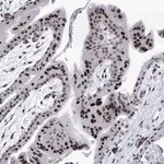 Merck Anti-SART1 antibody produced in rabbit