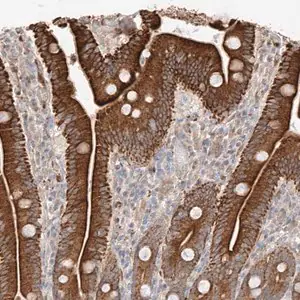 Merck Anti-GCNT1 antibody produced in rabbit
