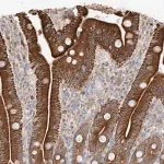 Merck Anti-GCNT1 antibody produced in rabbit