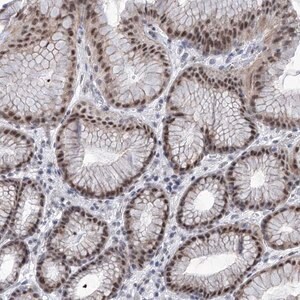 Merck Anti-SART1 antibody produced in rabbit