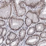 Merck Anti-SART1 antibody produced in rabbit