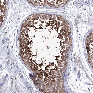 Merck Anti-KLHL17 antibody produced in rabbit