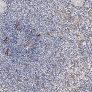 Merck Anti-ITGAD antibody produced in rabbit