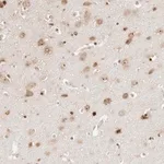 Merck Anti-FKBP14 antibody produced in rabbit