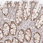 Merck Anti-ITGB3BP antibody produced in rabbit