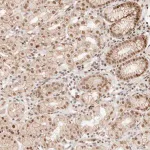 Merck Anti-HOXC5 antibody produced in rabbit