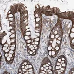 Merck Anti-GPR142 antibody produced in rabbit