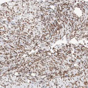 Merck Anti-ZNF512 antibody produced in rabbit