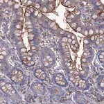 Merck Anti-EPHA8 antibody produced in rabbit