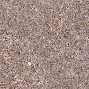 Merck Anti-AIM2 antibody produced in rabbit