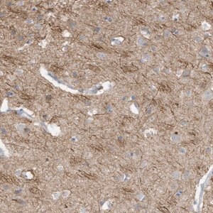 Merck Anti-GTPBP2 antibody produced in rabbit