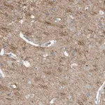 Merck Anti-GTPBP2 antibody produced in rabbit