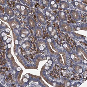 Merck Anti-ABCG1 antibody produced in rabbit