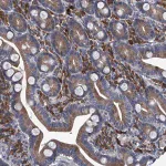 Merck Anti-ABCG1 antibody produced in rabbit