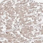 Merck Anti-MTUS2 antibody produced in rabbit