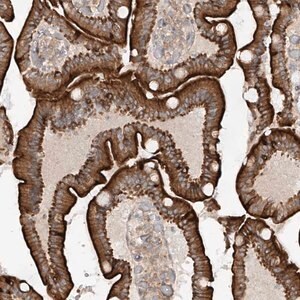 Merck Anti-MTUS2 antibody produced in rabbit