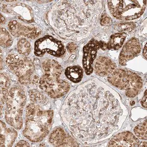 Merck Anti-MTX2 antibody produced in rabbit