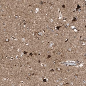 Merck Anti-SYNJ2 antibody produced in rabbit