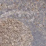 Merck Anti-CSNK1G3 antibody produced in rabbit
