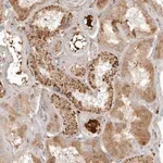 Merck Anti-KLHL38 antibody produced in rabbit