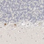 Merck Anti-TSEN2 antibody produced in rabbit