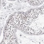 Merck Anti-GNL2 antibody produced in rabbit