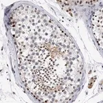 Merck Anti-TESK2 antibody produced in rabbit